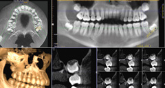Dental CT im Dentalklinik Dr. Toka
