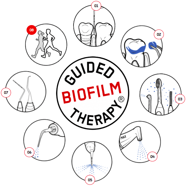 EMS - Guided Biofilm Therapy