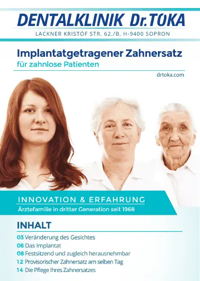 Implantatgetragener Zahnersatz